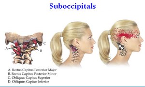 4--Suboccipitals